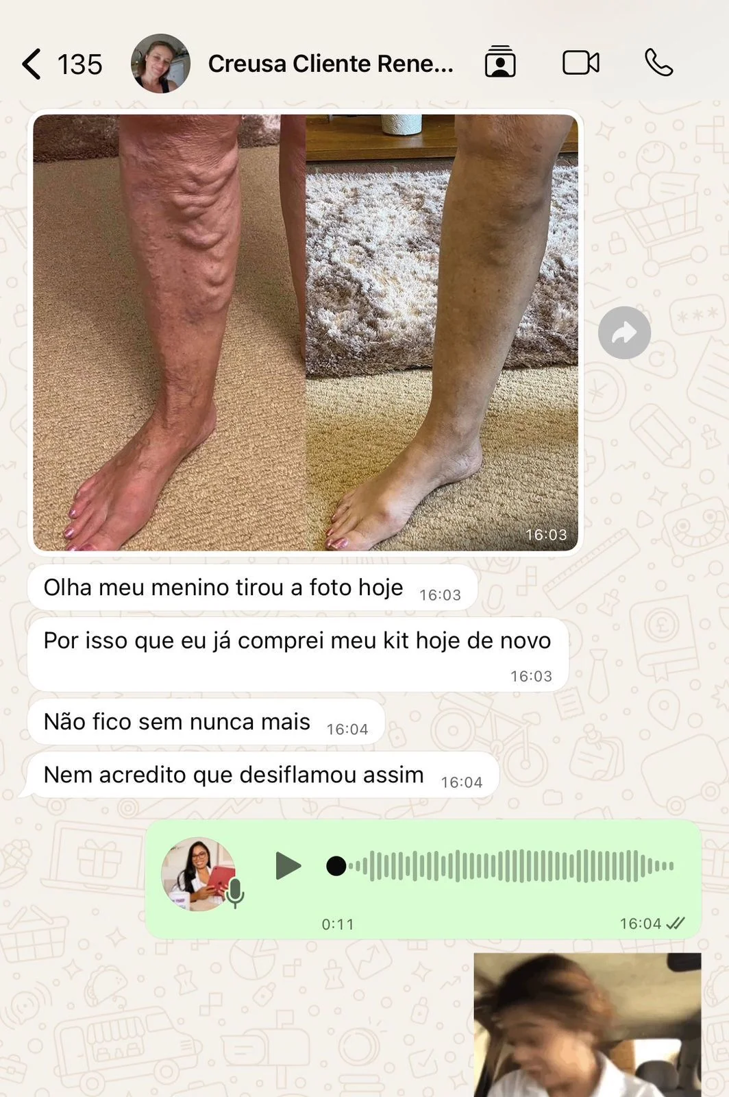 depoimento-creusa.webp