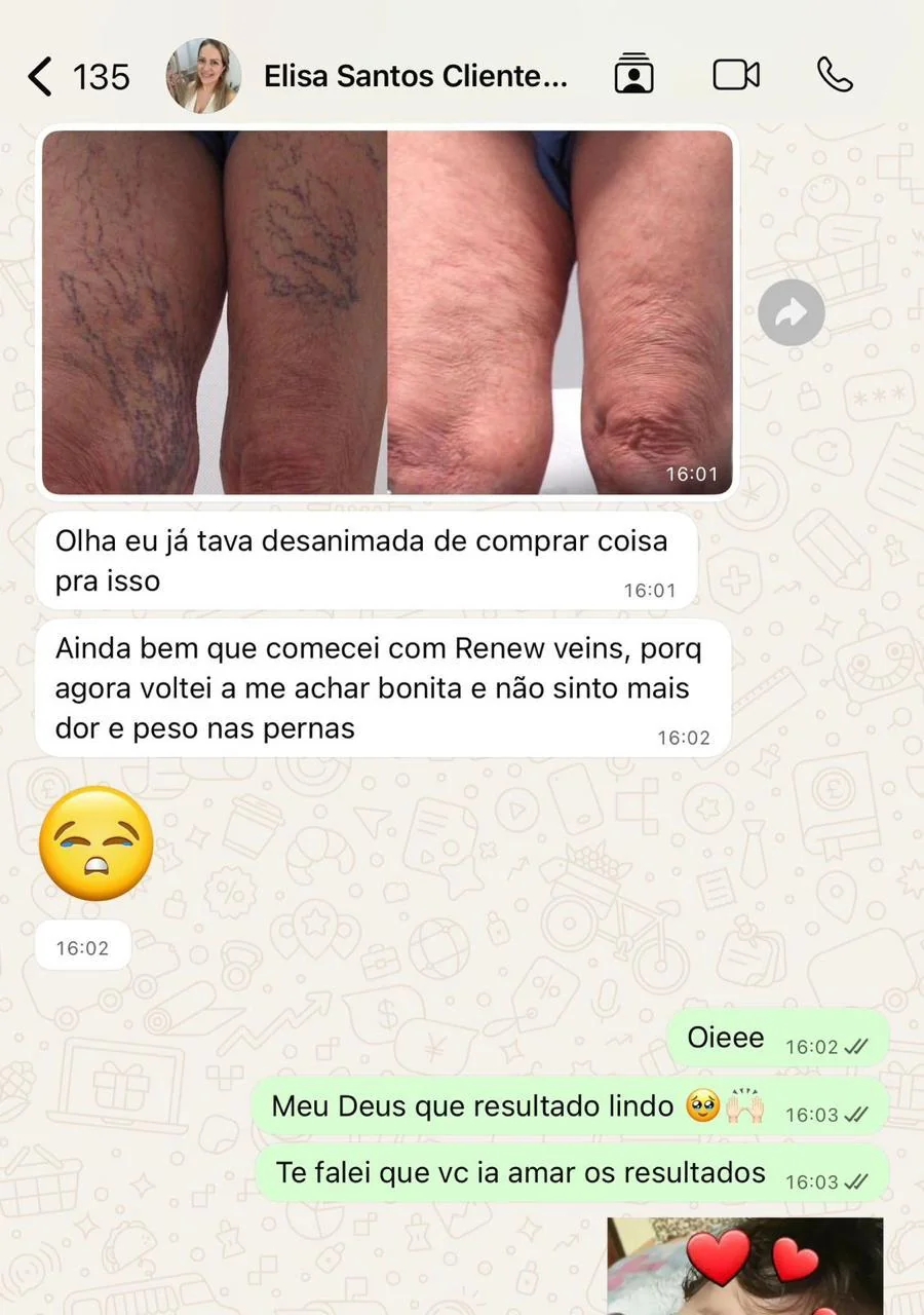 depoimento-elisa.webp